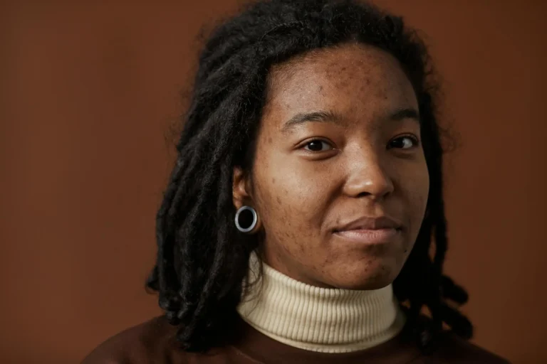 visage de femme noire avec des taches brunes